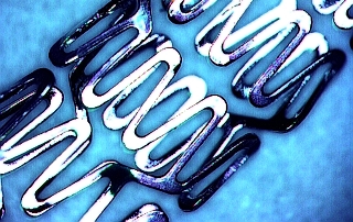 Stent Stent