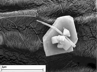 Particle on a fibre - Partikel auf einer Faser Partikel auf einer Faser