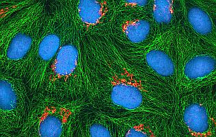 HeLa-Zellen - HeLa cells HeLa Zellen